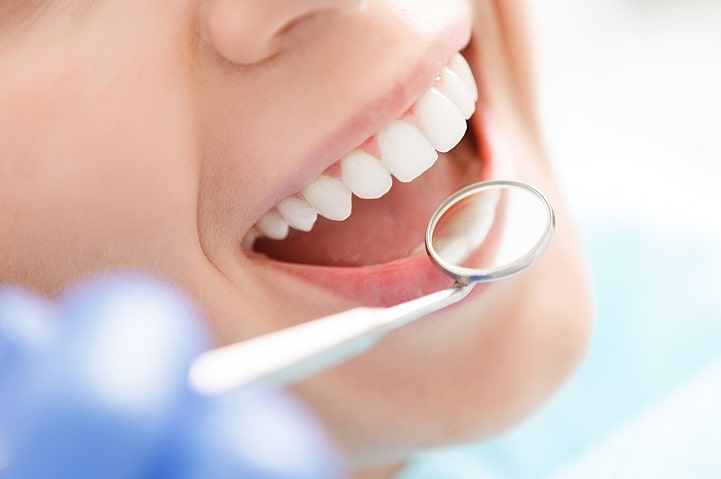 How You and Your Employees Can Benefit From Dental Insurance